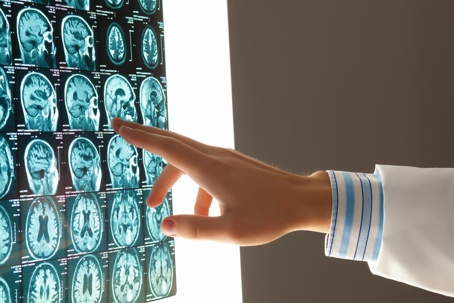 Hudson Valley’s Brain Injury Lawyer